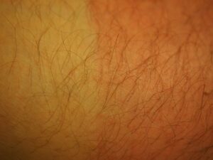 Zadbaj o swoją skórę! Gabinet medycyny estetycznej Lublin – dermatologia